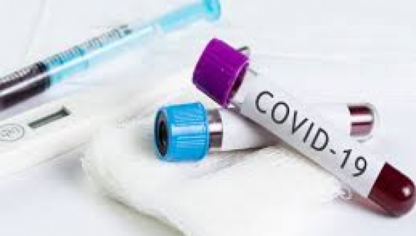 Chinese study not sufficient to conclude COVID-19 is sexually transmitted - Experts