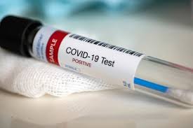 COVID-19: Oyo tests 3,433 samples in 3 months
